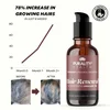 Liposomal Hair Renewal - Infographic